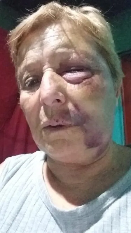 golpeada (1)